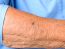 Close up detail of the forearm of an elderly woman showing the wrinkles and age spots of the skin in a sign of old-age and loss of elasticity