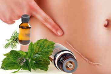 Os 10 óleos essenciais para realizar as suas massagens anti-cicatriz